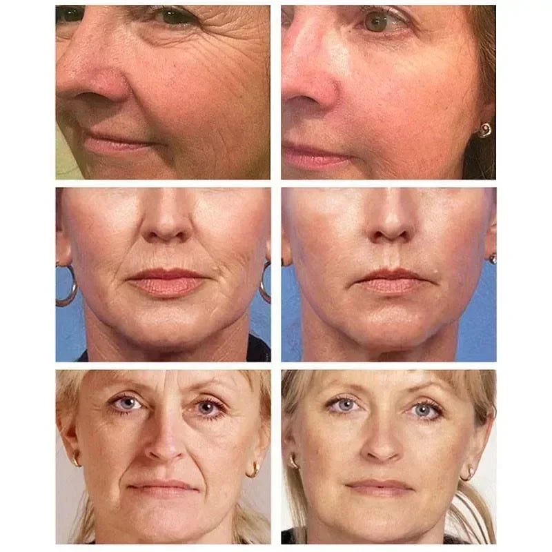 Pure Collagen Face Serum Remove Wrinkle Firming Lifting Anti-Aging Essence Fade Fine Lines Whitening For Moisturizing Skin Care