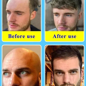 Hair Growth Essential Loss Regrowth Treatment Strengthens Hair Nourishes Scalp Light Weight Non Greasy Improve Scalp Circulation