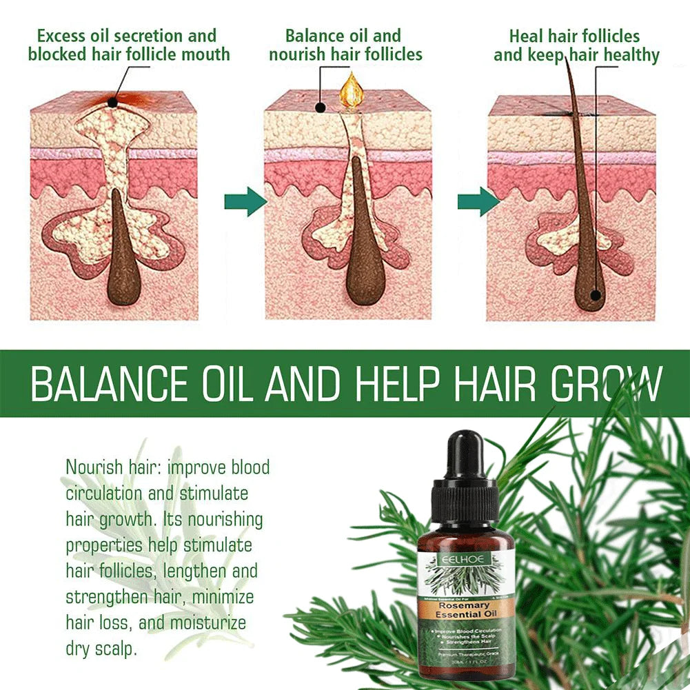 Rosemary Oil Hair Growth Essential Coconut Oil Improve Hair Loss And Nourishes Strengthen Hair Roots Scalp Treatment Hair Care