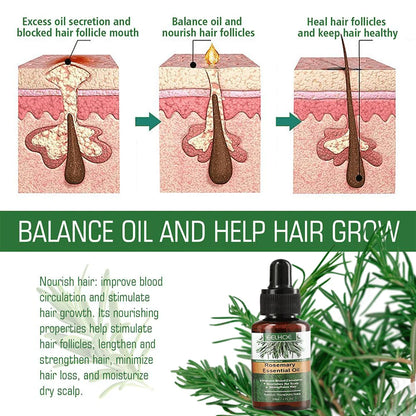 Rosemary Oil Hair Growth Essential Coconut Oil Improve Hair Loss And Nourishes Strengthen Hair Roots Scalp Treatment Hair Care
