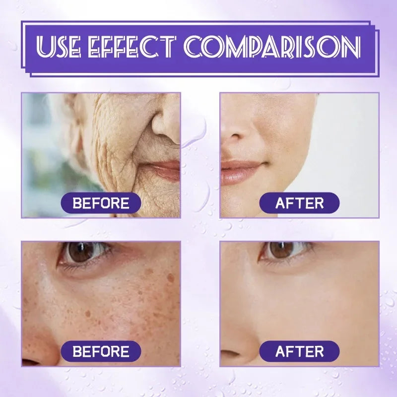 Hoygi Niacinamide Facial Serum Vitamin B3 Wrinkles Pigment Dark Spot Removal Correcting Glow Serum Face Whitening Moisturizer