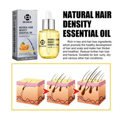 Hair Growth Essential Oil Treatment Seborrheic Alopecia Follicle Repairing Reduce Hairline Baldness Dense Growing Hairs Lotion
