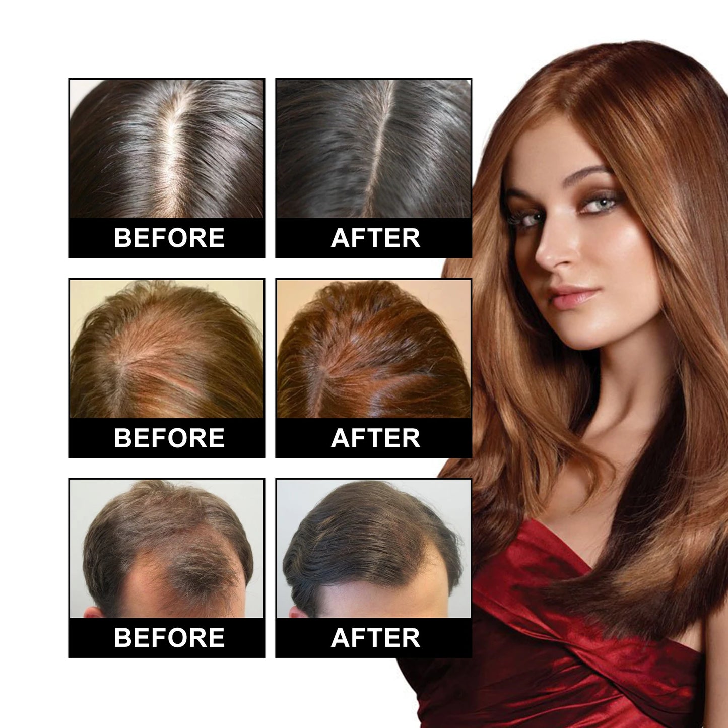 Ouhoe Hair Care Oil for Thinning Hair Scalp Treatment Serum to Strengthen Roots and Repair Damaged Hair 30ml Natural Formula