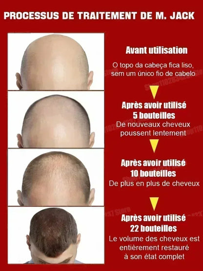 Get Fuller and Healthier Hair with Hair Care Essential Oils - Hot Selling Product