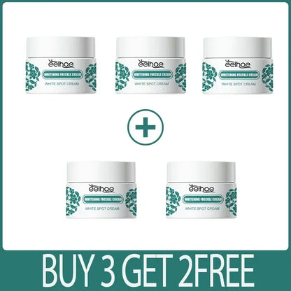 Removal Dark Spots Whitening Freckle Cream Leaving skin looking brighter clearer and more luminous prevent future discoloration