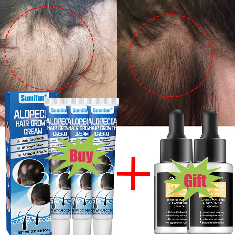 7 days Fast Hair Growth Cream Anti Hair loss Prevent Baldness Scalp Treatment Repair Roots Beauty Health Hair Care For Men Women