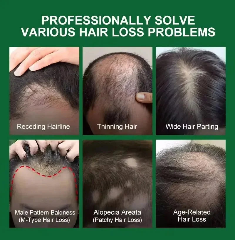 Fast Hair Growth Serum Spray Anti Hair Loss Prevent Baldness Scalp Treatment Repair Roots Beauty Health Hair Care For Men Women