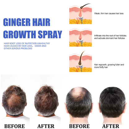 Ginger Hair Growth Serum Spray Essence Prevent Hair Loss Scalp Treatment Improve Alopecia Strengthening Roots Hair Care Fluid