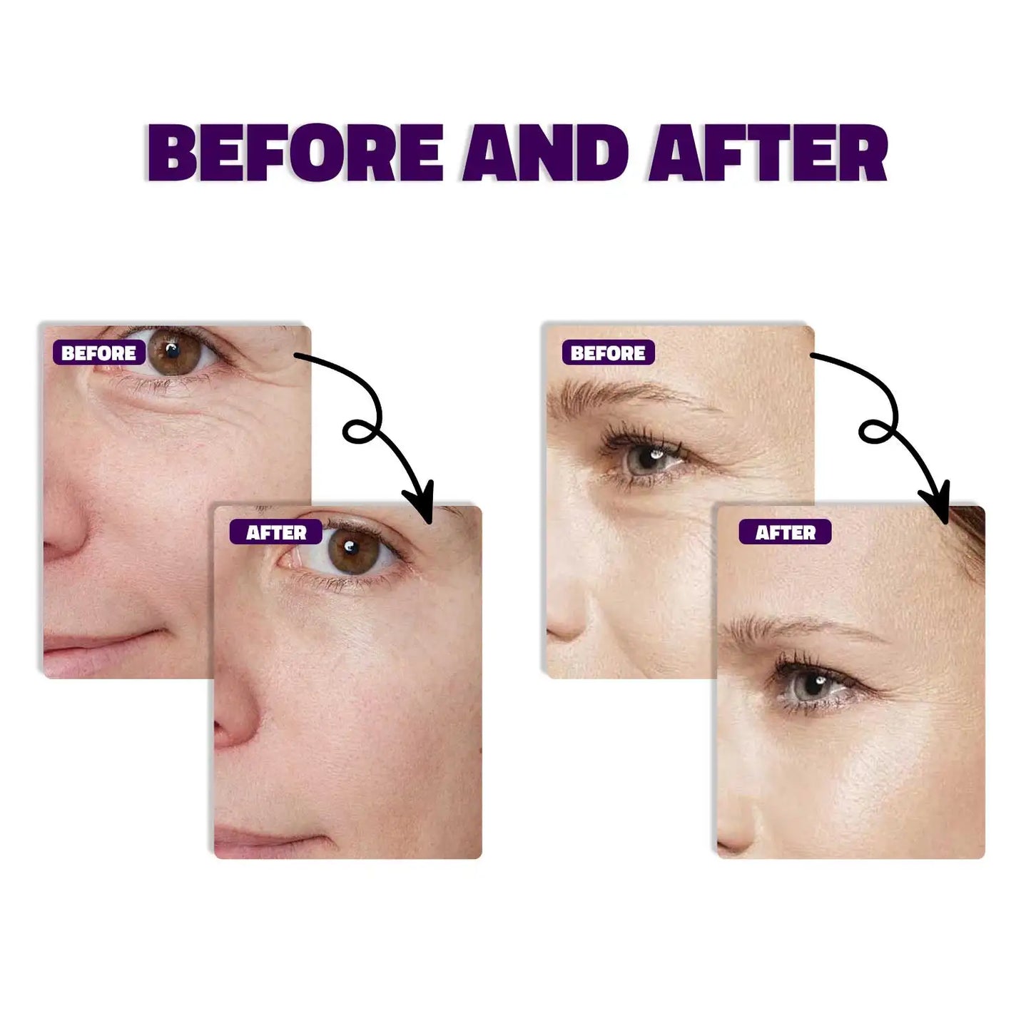 30ML Bakuchiol Serum With Retinol Skin Moisturizing & Firming Smooth Fine Lines Essence for Wrinkles  Anti-aging Serum for Women