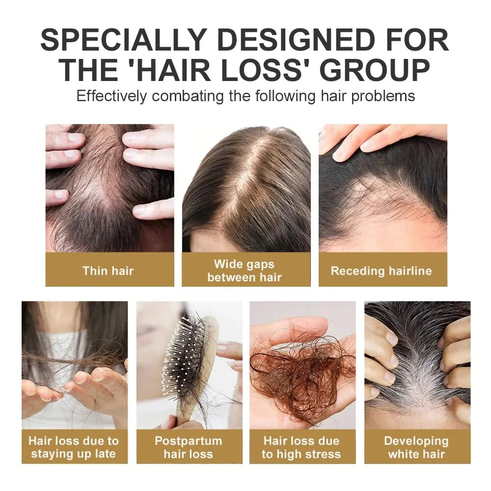 Rosemary Hair Growth Serum Anti Hair Loss Baldness Fast Regrowth Hair Care Oil Repair Damaged Hair Scalp Treatment For Women Men