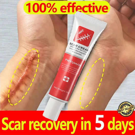 Effective Scar Removal Cream Fast Treatment Stretch Marks Burn Surgical Scars Acne Spots Repair Whitening Moisturizing Skin Care