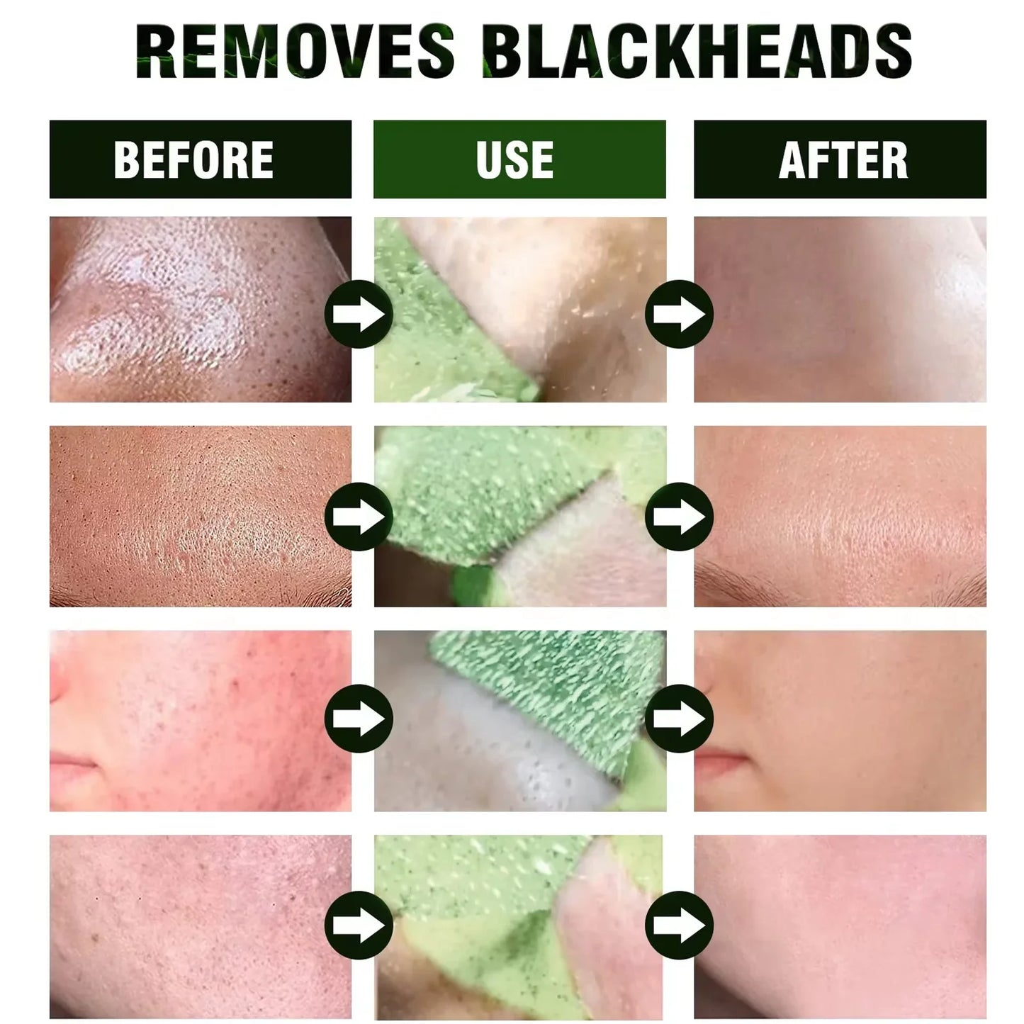 Remove Blackhead Mud Mask Green Tea Face Clean Stick Dispel Pimple Blemish Shrink Pores Oil Control Exfoliating Whiten Skin Care