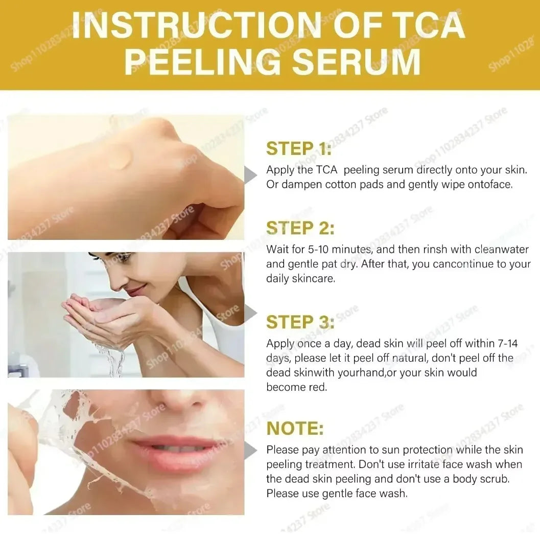 With Malic Acid And Citric Acid For Face  Facial Peel 40% Peeling Serum Peeling Serum Chemical Peel