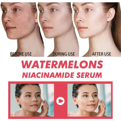 1/3pcs Watermelon nicotinamide Light Bulb serum deep Moisturizing Skin Brightening Face lightning Essence skin care for women