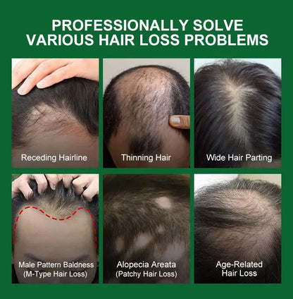 7 Days Fast Hair Growth Serum Ginger Anti Hair Loss Essential Oil Promote Regrowth Thicken Hair Care For Men Women Beauty Health