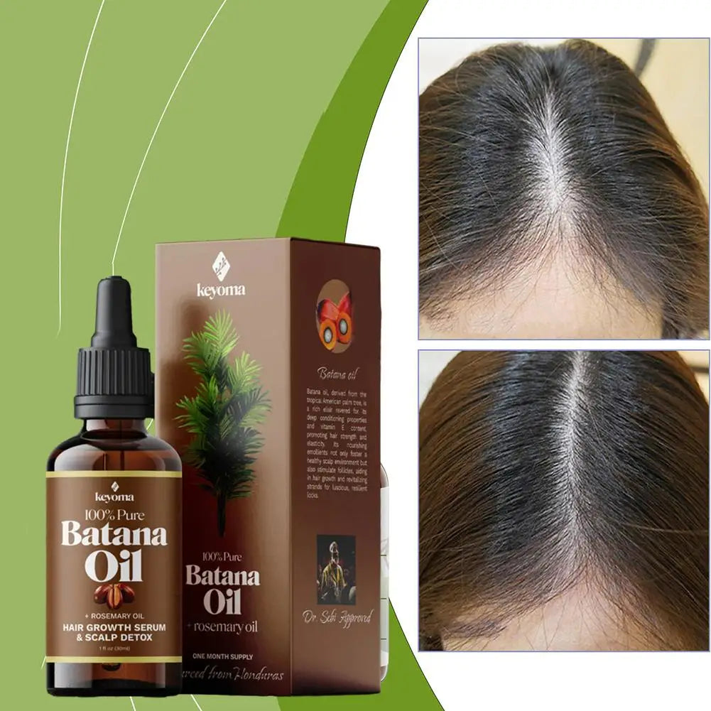 Keyoma Rosemary Mint Hair Strengthening Oil Nourishing Anti Hair Loss Essence Treatment Split Ends Dry Essential Oil Hair Care