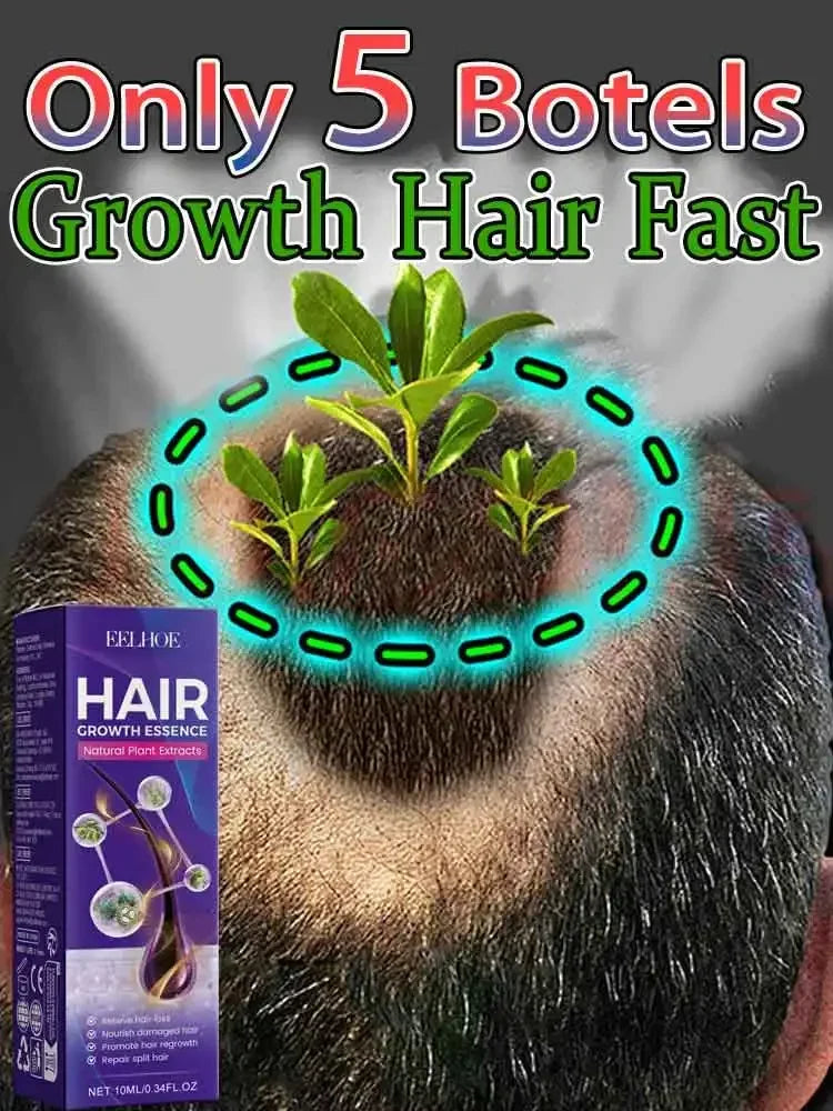 98% of buyers buy again, have more and more hair, say goodbye to baldness, thick hair,Hot selling product