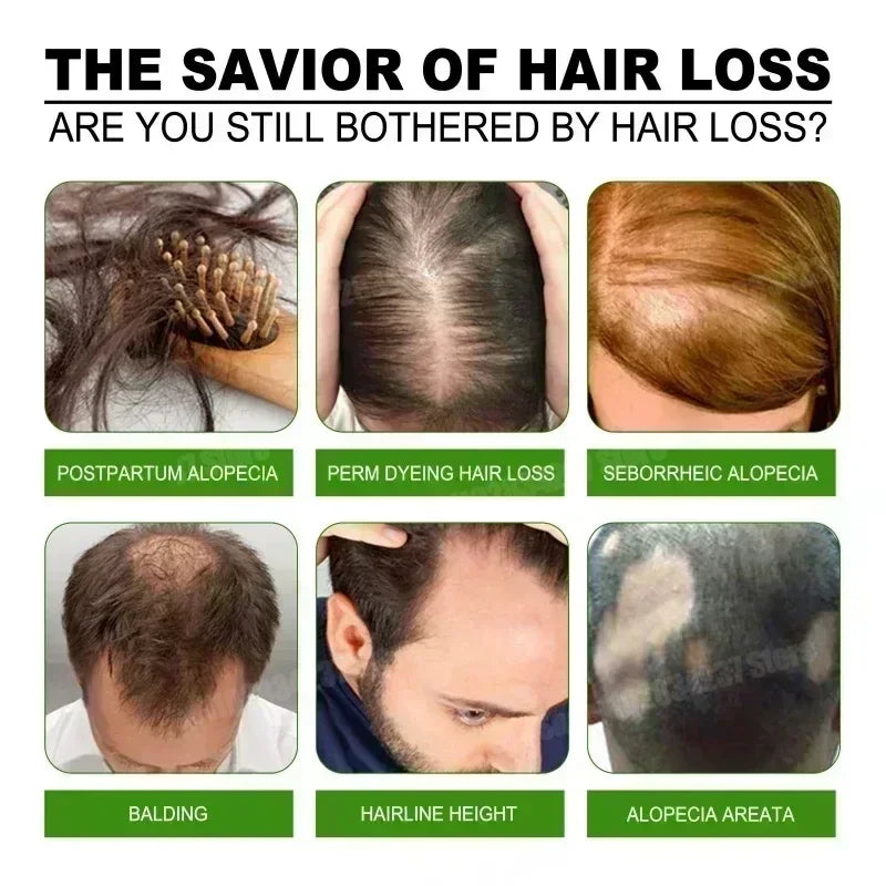 Get Fuller and Healthier Hair with Hair Care Essential Oils - Hot Selling Product