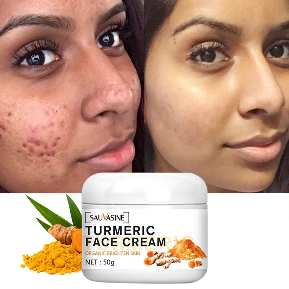 Turmeric lemon Skin Care products Acne Dark Spot Remover Whitening Brighten Facial Serum Face Cream Cleanser Serum Oil Cosmetics