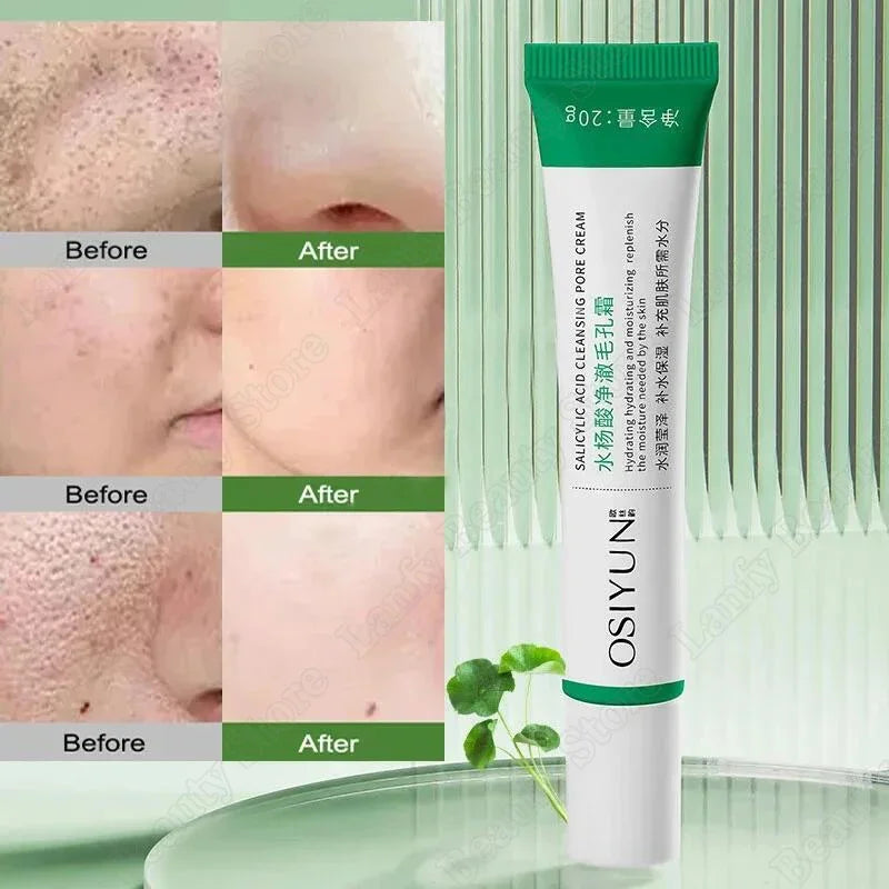 Salicylic Acid Pore Clearing Cream Shrink Pores Remove Blackheads Acne Brighten Moisturizing Smooth Skin Care Korean Products