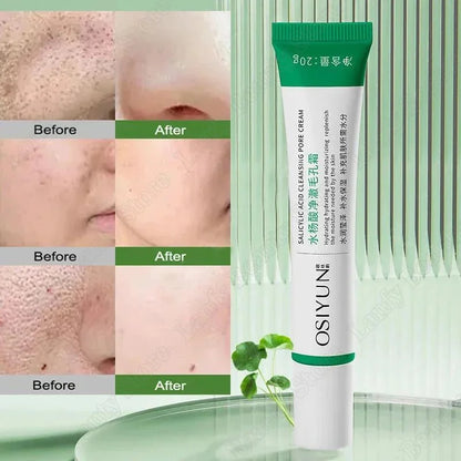 Salicylic Acid Pore Clearing Cream Shrink Pores Remove Blackheads Acne Brighten Moisturizing Smooth Skin Care Korean Products