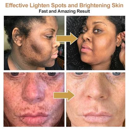 Turmeric lemon Skin Care products Acne Dark Spot Remover Whitening Brighten Facial Serum Face Cream Cleanser Serum Oil Cosmetics