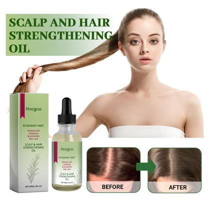 Rosemary Mint Hair Growth Oil Hair Roots Scalp Treatment Improve Androgenetic Alopecia Scalp Care Serum Strengthen Hair Roots