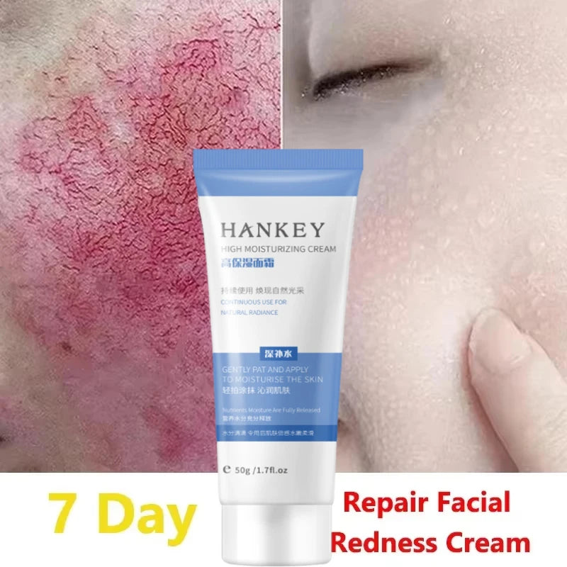 Facial Redness Repair Cream Improve Sensitive Skin Moisturizer Hydrate Sooth Lotion Removal Rosacea Spider Vein Korean Cosmetic