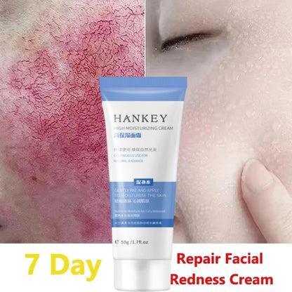 Facial Redness Repair Cream Improve Sensitive Skin Moisturizer Hydrate Sooth Lotion Removal Rosacea Spider Vein Korean Cosmetic