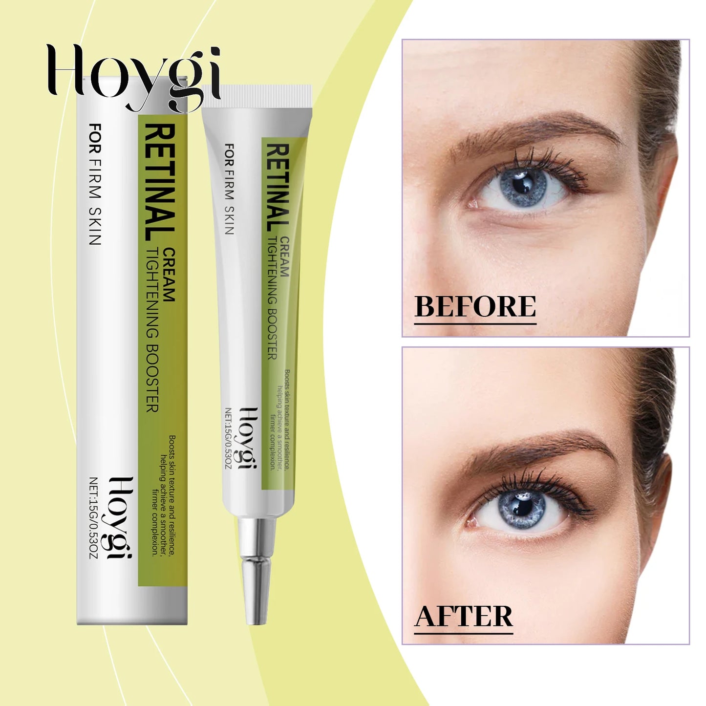 Hoygi 15g Retinol Eye Cream Gentle Anti Aging Formula for Delicate Eyes Hydrate Smooth Texture Reduce Fine Lines Night Repair