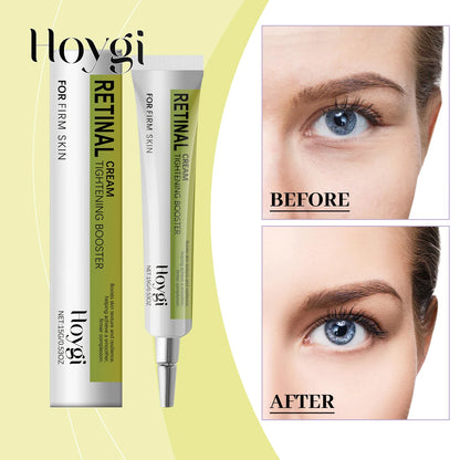Hoygi 15g Retinol Eye Cream Gentle Anti Aging Formula for Delicate Eyes Hydrate Smooth Texture Reduce Fine Lines Night Repair