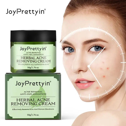 Herbal Acne Face Cream by JoyPretty - Pimple Marks RemovalOil Control & Moisturizing Facial Cream for Pockmark Smoothing