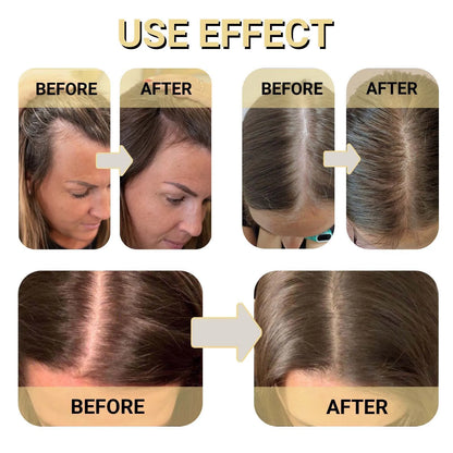 Rosemary Hair Growth Serum Anti Hair Loss Baldness Fast Regrowth Hair Care Oil Repair Damaged Hair Scalp Treatment For Women Men