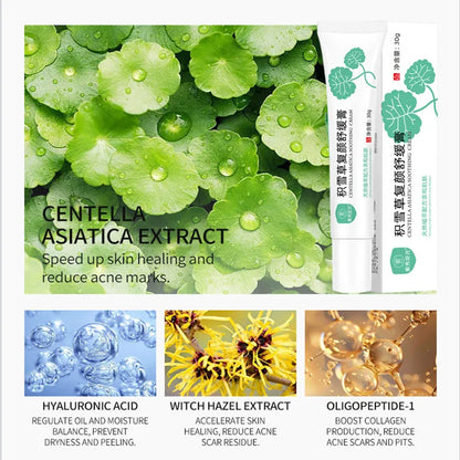 Facial Redness Repair Cream Improve Sensitive Muscles Acne Rosacea Dry&Itchy Skin Moisturizer Lotion Korean skincare products