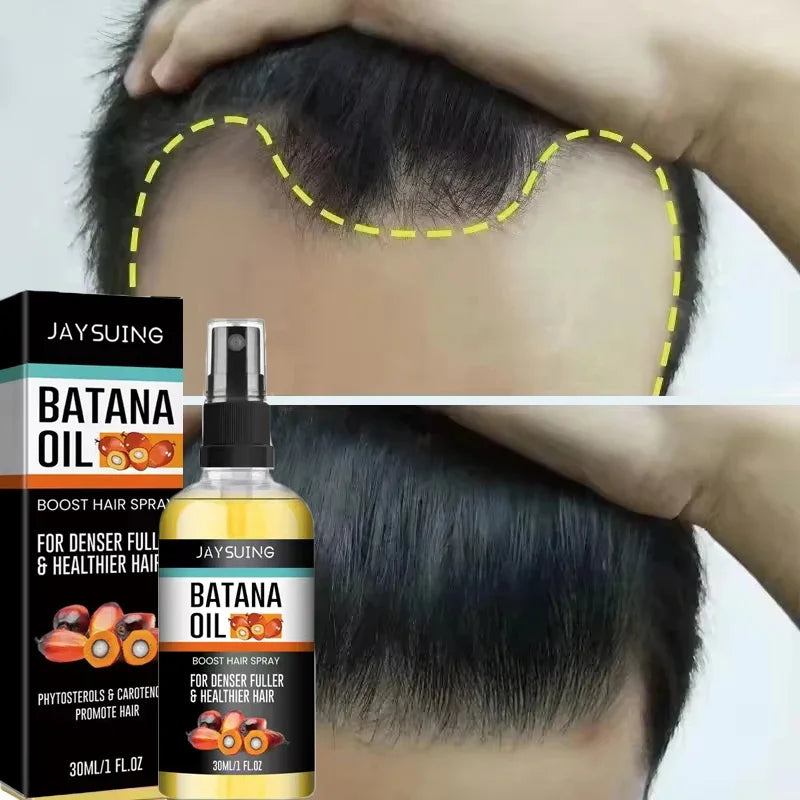 Batana Oil Hair Growth Serum Spray Repair Hair Nourish Root Regrowth Hair Anti Hair Loss Essence Men Women Hair Care Products