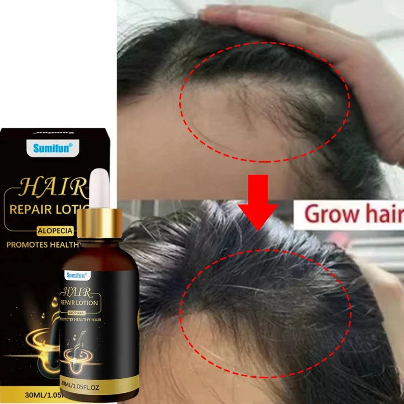 Fast Hair Growth Set Batana Oil Traction Alopecia Hair Mask Anti Break Loss Hair Growth Oil Baldness Treatment Hair Health Care