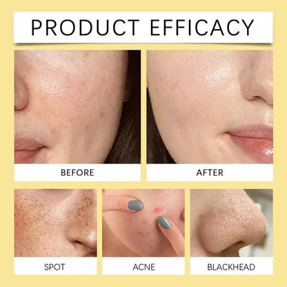 Vitamin Niacinamide Concentrated Face Care Pad, Cleansing Pads For Face And Body, Gentle Cleanser For All Skin Types