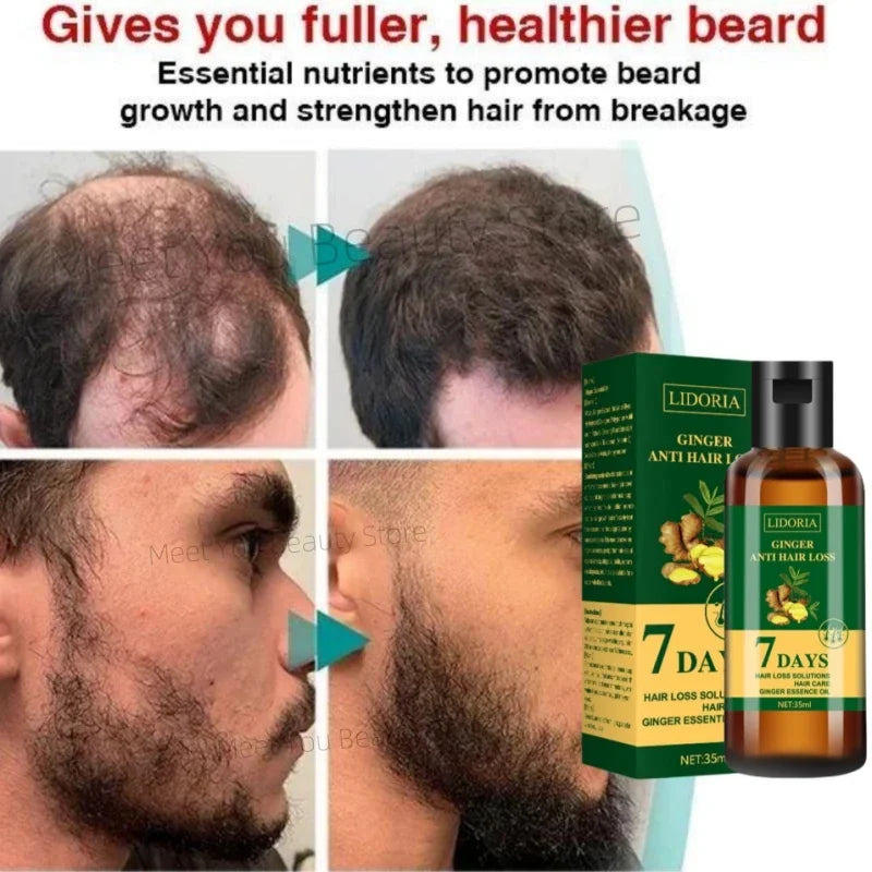 7 Days Fast Hair Growth Serum Ginger Anti Hair Loss Essential Oil Promote Regrowth Thicken Hair Care For Men Women Beauty Health