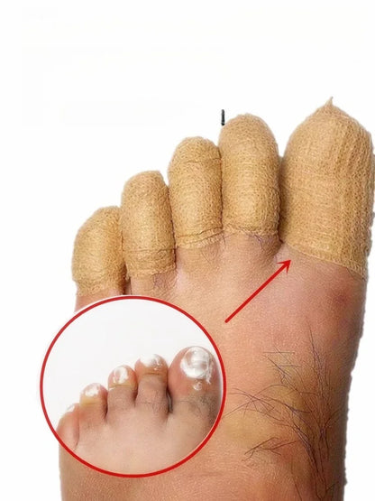 Toe protection, self-adhesive bandage, fungal nail polish, foot and finger protection, nail coating, toe and finger protection