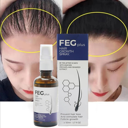 2pcs FEG hair growth spray original Organic Anti Hair Loss Hair Growth Treatment Oil For Thicker Long Hair -50ML
