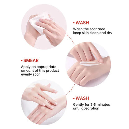 Fast Scar Removal Cream Treatment Stretch Marks Burn Surgical Scar Acne Spots Repair Gel Whitening Moisturizing Smooth Skin Care