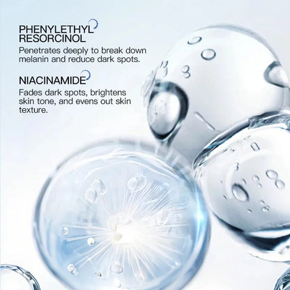 Effective Whitening Freckles Face Cream Remove Melasma Dark Spots Fade Pigmentation Acne Scars Moisturizing Brighten Beauty Care