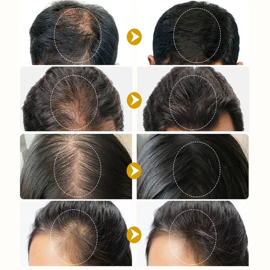 Batana Oils Fast Hair Growth Serum Anti-loss Hair Regrowth Essential Oil Roller Scalp Treatment Hair Care Products for Men Women