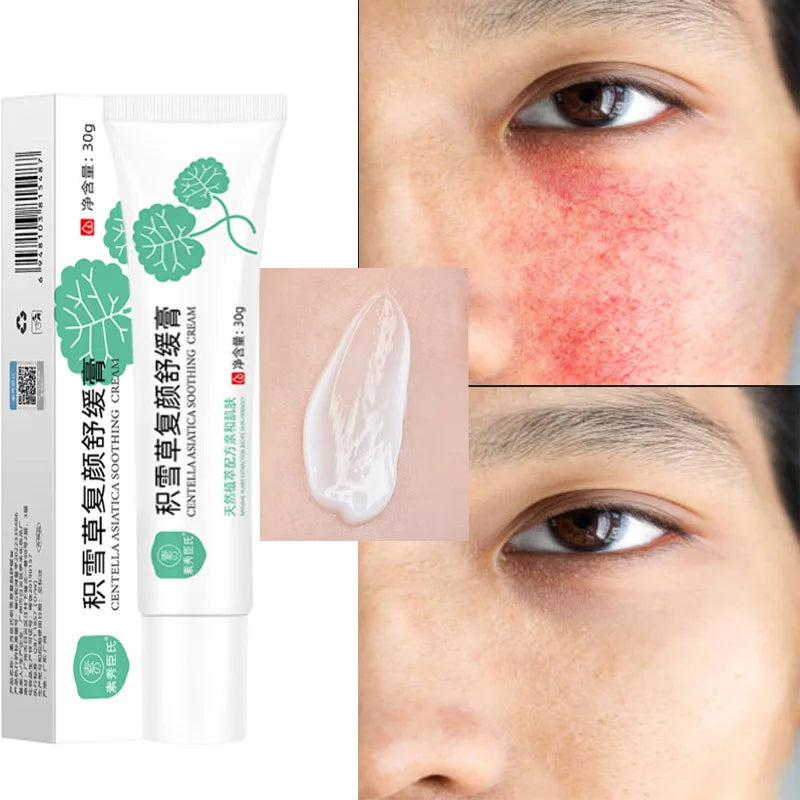 Facial Redness Repair Cream Improve Sensitive Muscles Acne Rosacea Dry&Itchy Skin Moisturizer Lotion Korean skincare products