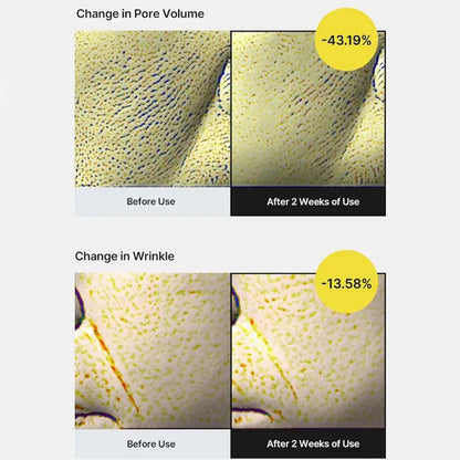 Korean Retinol Wrinkle Remover Cream Shot Tightening Firming Fine Line Enhancer Moisturizing Pore Shrinking Repair Serum Care