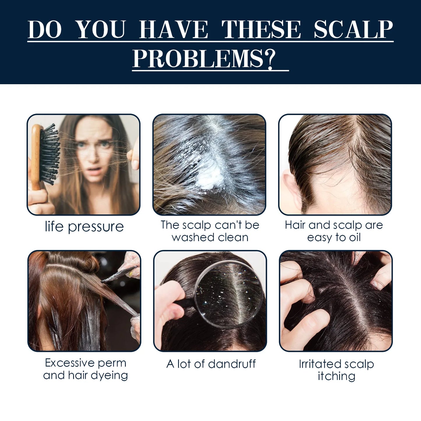 Dandruff Removal Spray Anti Itching Scalp Treatment Repair Dryness Damaged Prevent Hair Lo-ss Oil Control Nourishing Hair Serum