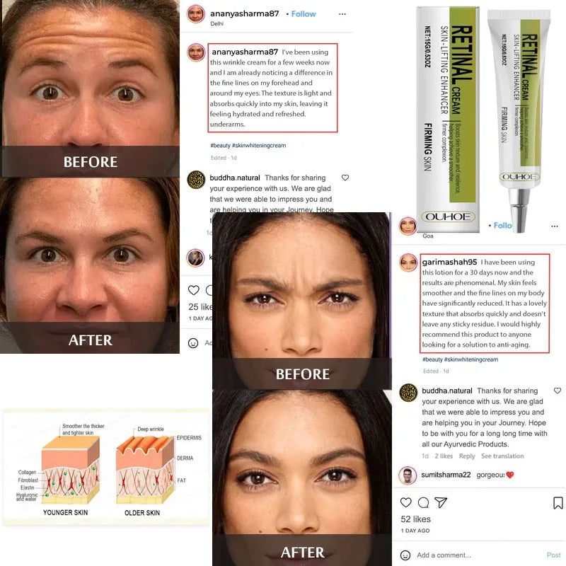 Retinol Cream Tightening Anti Wrinkle Improve Sagging Moisturizing Smoothing Lightening Firming Radiant Fine Lines Removal Cream