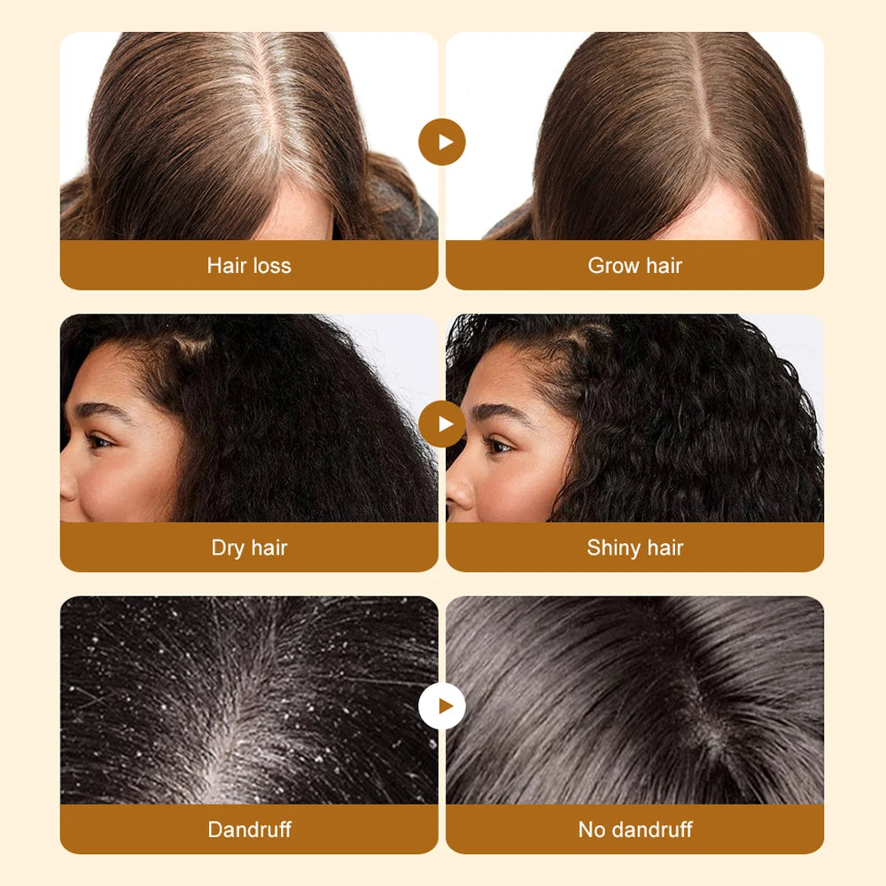 Batana Oil for Hair Growth 100% Pure Natural Plant Extract Repairs Damaged Hair for Hair Thickness & Scalp Hair Care Essence Oil