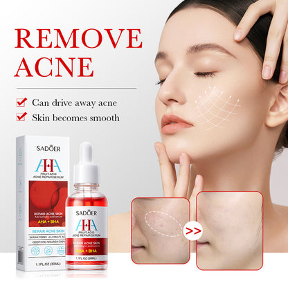 2 Pieces, Vitamin C Face Brightening Serum & AHA + BHA Acne Skin Repair Serum, Removes Acne,Whiten Black Spots, can Combine With Vitamin C, Get rid of Acne Marks and Pimples, Moi 30ml each