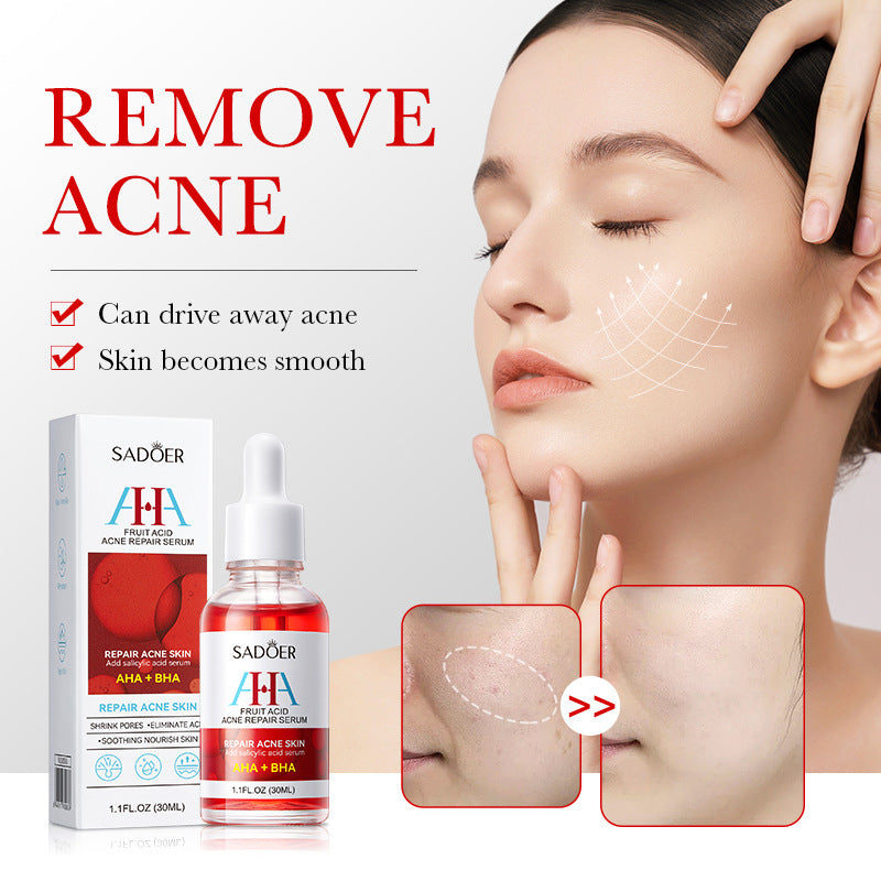 AHA + BHA Fruit Acid Acne Repair Serum, With Salicylic Acid , Shrinks Pores, Eliminates Acne, Nourish and Smoothens Skin, Repair Acne Marks, Can Combine with Vitamin C, Mois 30ml